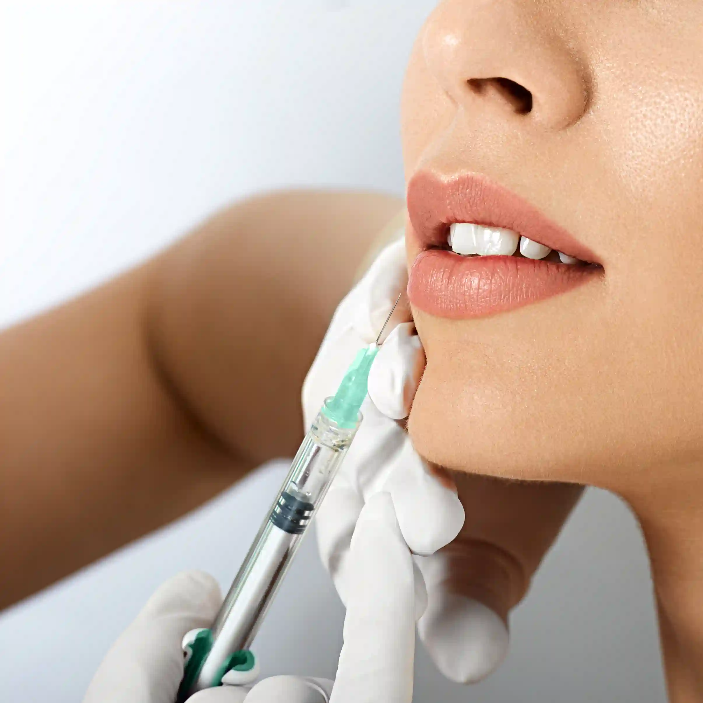 DolphinMed Polikliniği profesyonel dolgu uygulamaları ile yüz hattı tasarımı.