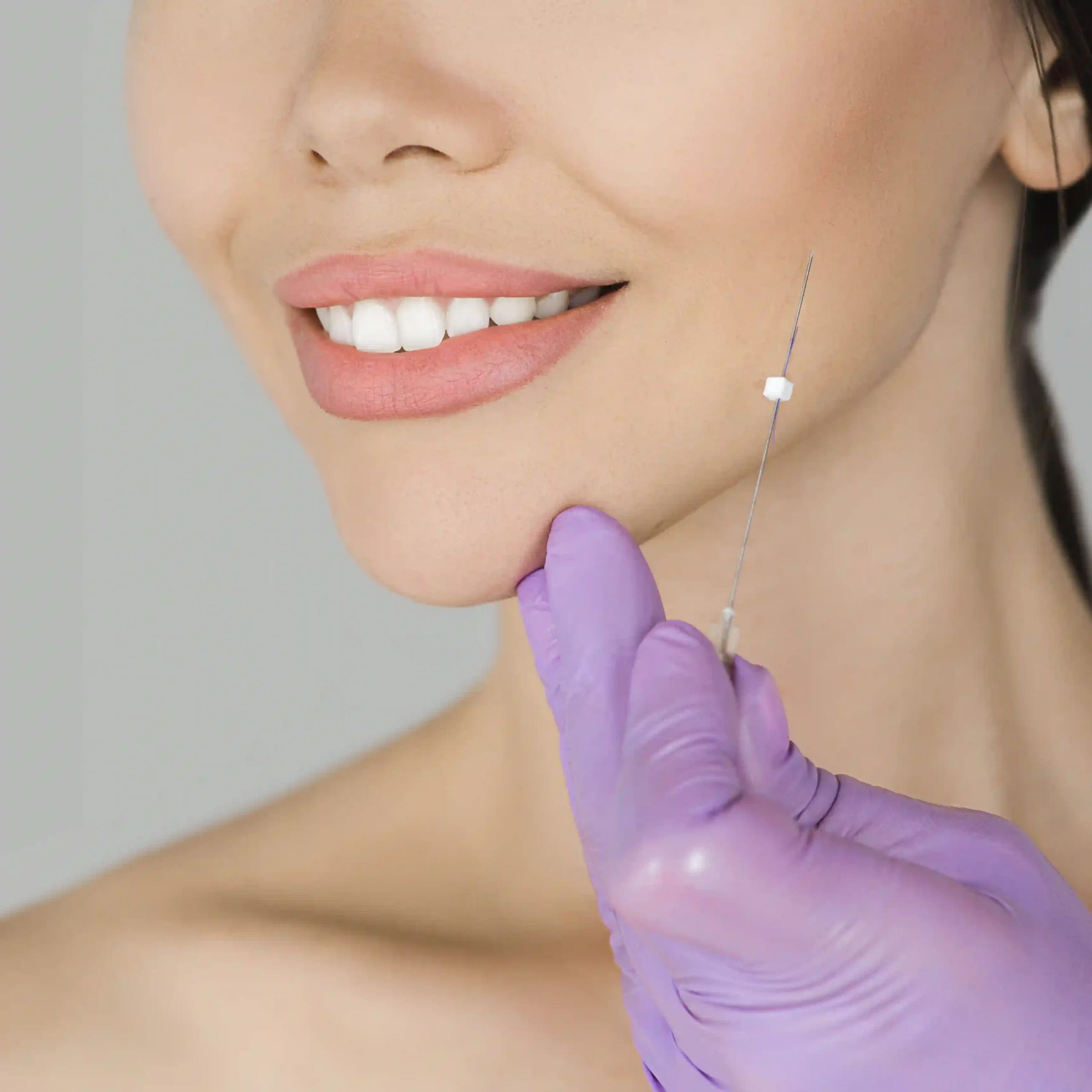 DolphinMed Polikliniği profesyonel İp Askı ile Yüz Germe ve ameliyatsız estetik uygulamaları.