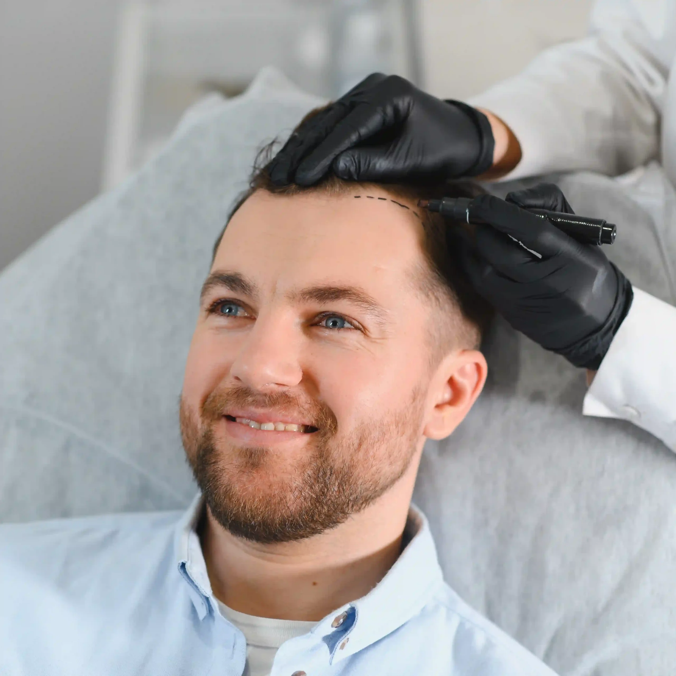 DolphinMed Polikliniği bünyesinde uzman doktor denetiminde gerçekleştirilen profesyonel Saç Ekimi planlaması ve FUE uygulama süreci.