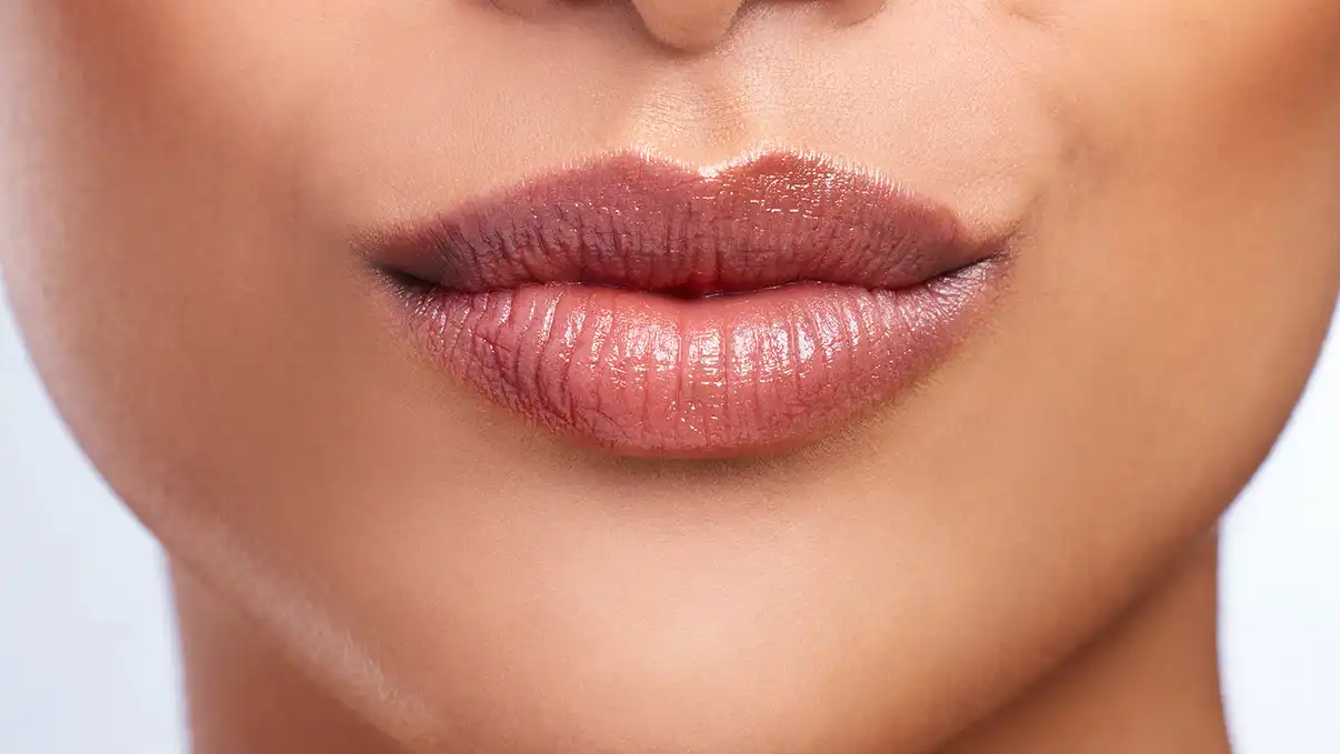 Dr. Burak Kaymak tarafından gerçekleştirilen kişiye özel denizli dudak dolgusu planlama aşaması.