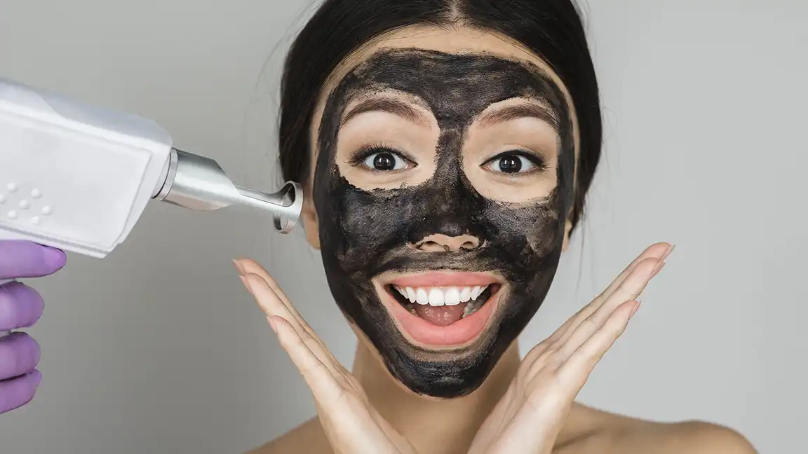 Denizli karbon peeling ve Q-switch lazer cilt tonu düzenleme süreci.