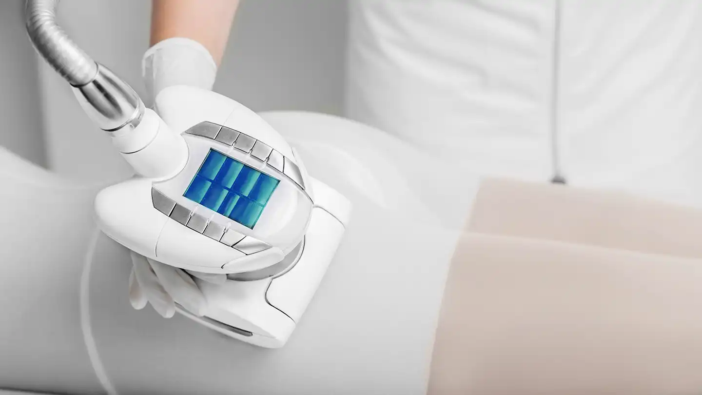 Denizli bölgesel incelme protokolü kapsamında soğuk lipoliz ve radyofrekans cihazlarının doku üzerindeki etkisini gösteren teknik şema.