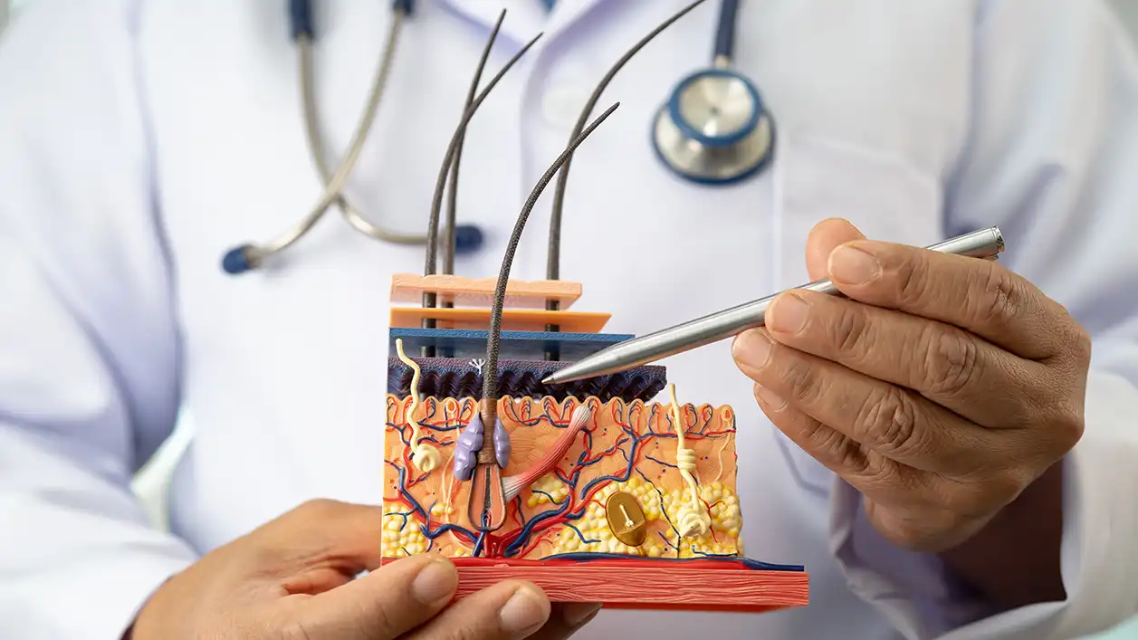 Denizli FUE ve DHI saç ekimi karşılaştırması kapsamında Choi kalem tekniği ve greft yerleştirme açılarının analizi.