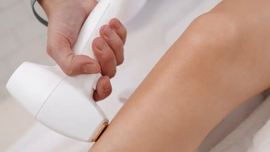 Lazer epilasyon teknolojilerinde kullanılan Alexandrite ve Diode dalga boylarının cilt üzerindeki etkisini gösteren teknik analiz.