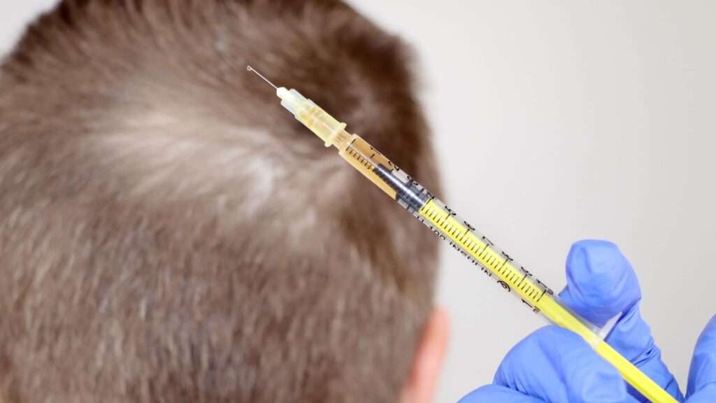 Saç Mezoterapisi Nedir — DolphinMed Polikliniği Denizli hekim kontrolünde medikal estetik görseli.